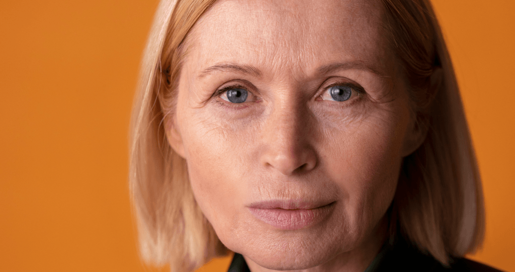 CYNEFILL Prestige Deep ZK MediGroup | CYNEFILL Prestige Deep