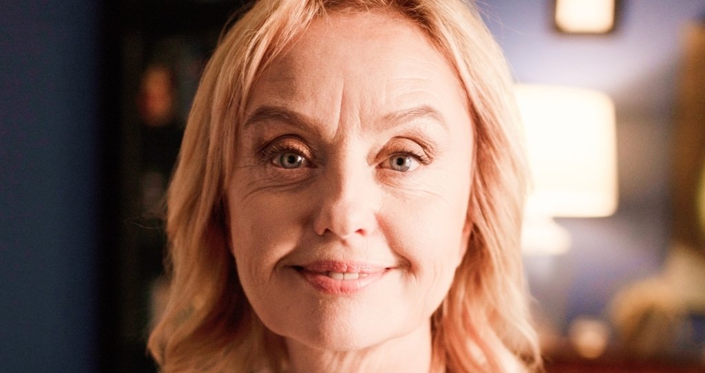 CYNEFILL Prestige Deep ZK MediGroup | CYNEFILL Prestige Deep