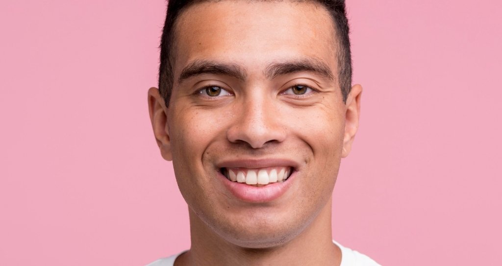 CYNEFILL Prestige Deep ZK MediGroup | CYNEFILL Prestige Deep