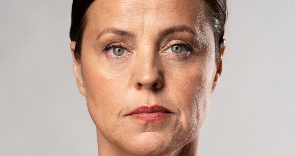 CYNEFILL Charm Classic ZK MediGroup | CYNEFILL Charm Classic