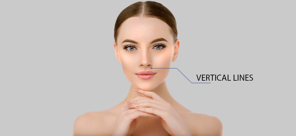 ZK MediGroup | How to remove nasolabial folds? Overview of the Korean filler CYNEFILL PRESTIGE DEEP