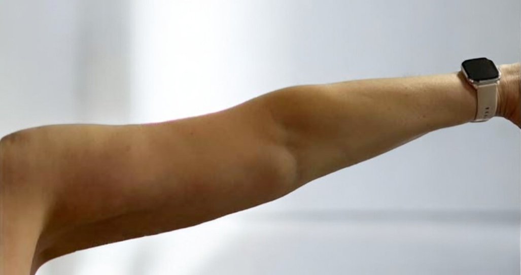 Lipolytic ZK MediGroup | Lipolytic