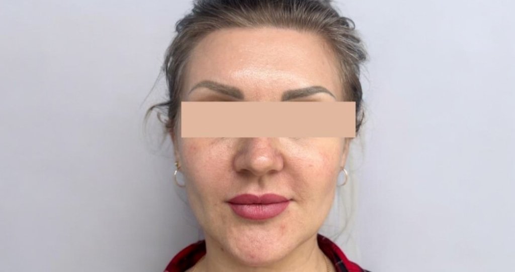 Lipolytic ZK MediGroup | Lipolytic