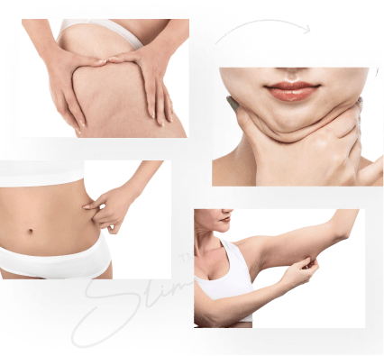 Lipolysis procedure illustration