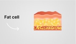 Injection process illustration