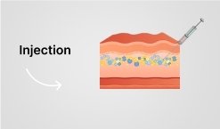 Injection process illustration