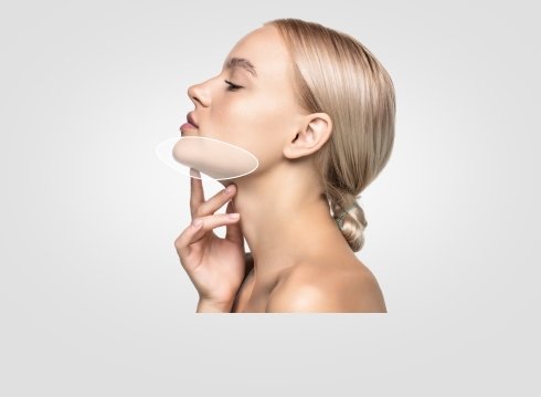 Lipolytic ZK MediGroup | Lipolytic