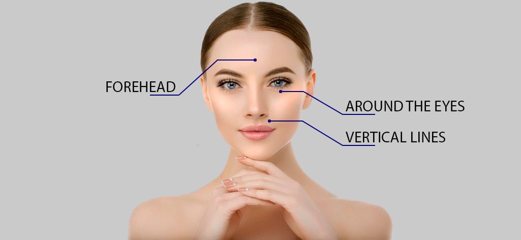 CYNEFILL Charm Classic ZK MediGroup | CYNEFILL Charm Classic