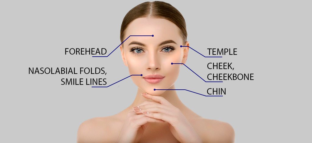 CYNEFILL STELLAR PLA ZK MediGroup | CYNEFILL STELLAR PLA