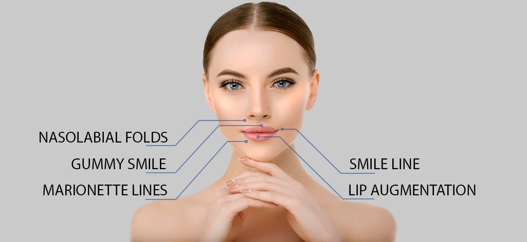 CYNEFILL Prestige Deep ZK MediGroup | CYNEFILL Prestige Deep