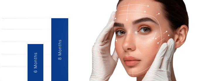 CYNEFILL Charm Classic ZK MediGroup | CYNEFILL Charm Classic