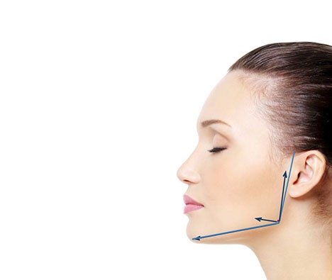 CYNEFILL Glamour Shape ZK MediGroup | CYNEFILL Glamour Shape