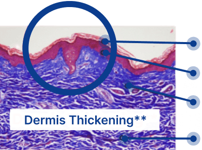 Skinbooster Detailed skin derm structure