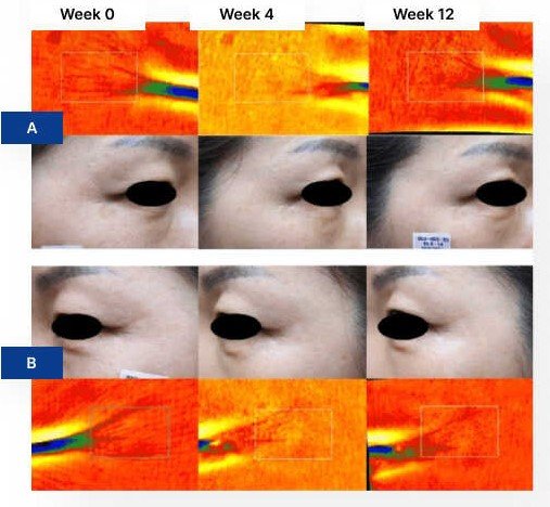 Skinbooster group-2732