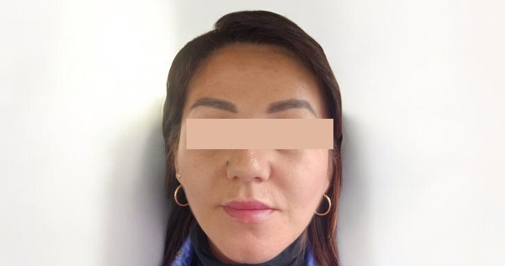 Lipolytic ZK MediGroup | Lipolytic