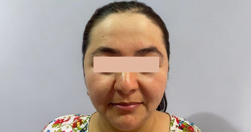 Lipolytic ZK MediGroup | Lipolytic