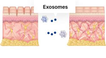 Exosome Skin Booster CYNEFILL ExoDual Before and after comparison of CYNEFILL® ExoDual treatment