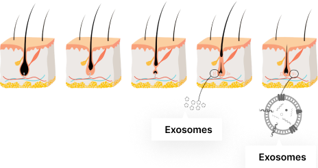 Exosome Skin Booster CYNEFILL ExoDual Illustration of exosomes-what-are-1