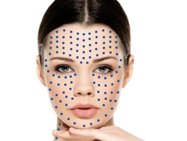 Exosome Skin Booster CYNEFILL ExoDual ZK MediGroup | Exosome Skin Booster CYNEFILL ExoDual