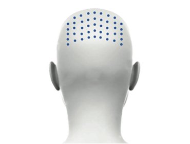 Exosome Skin Booster CYNEFILL ExoDual ZK MediGroup | Exosome Skin Booster CYNEFILL ExoDual