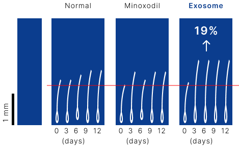 Exosome Skin Booster CYNEFILL ExoDual Illustration representing hair health improvement