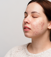 Cynefill NAD+ ZK MediGroup | Cynefill NAD+