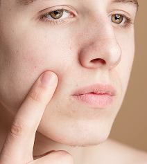 Cynefill NAD+ ZK MediGroup | Cynefill NAD+